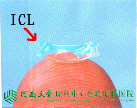 ICL植入術(shù)，高度近視患者的福音