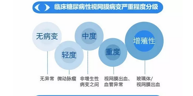 你造嗎？糖尿病晚期眼睛會(huì)致盲！