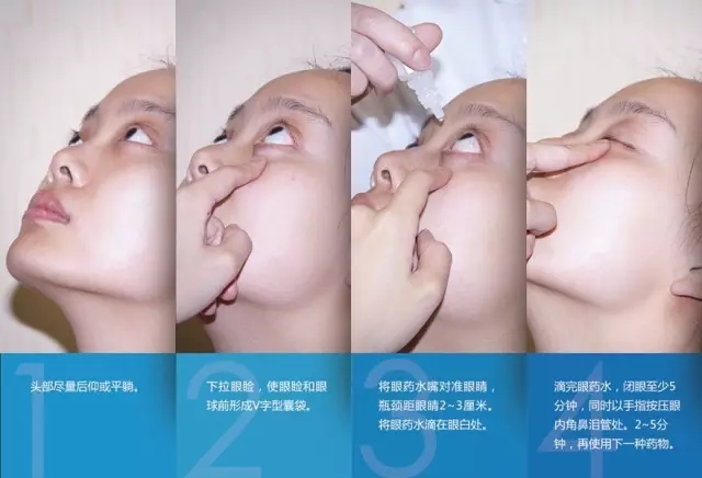 眼藥水你點(diǎn)對(duì)了嗎？快來(lái)看看！