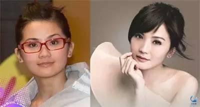 那些近視戴鏡暴丑的女明星們是做了什么變美了？？？
